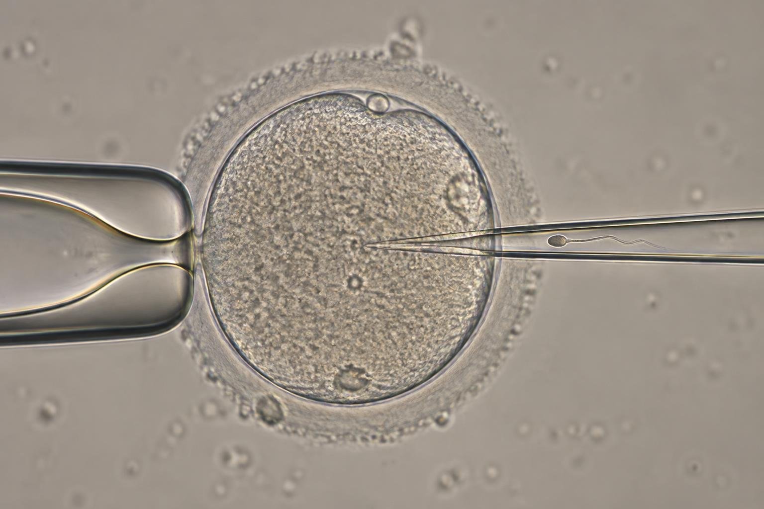 Illustration de l’ICSI avec ovocyte maintenu à gauche et micropipette d’injection à droite.