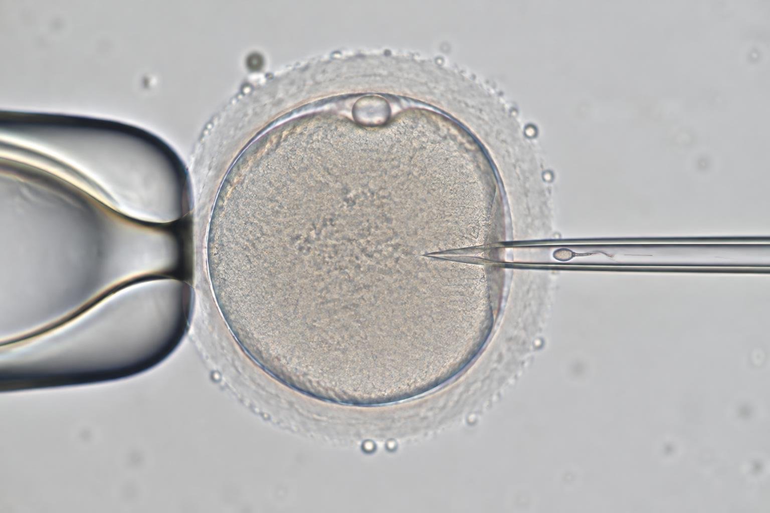Illustration inspirée de la microscopie en ICSI : ovocyte maintenu par une pipette à gauche et micropipette d'injection à droite.