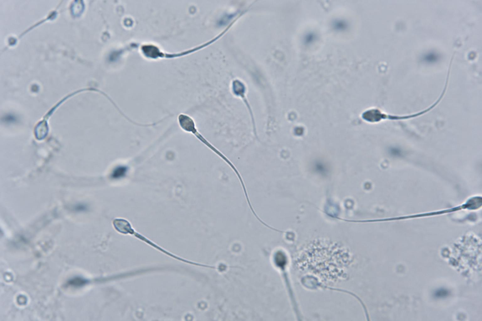 Spermatozoïdes humains observés au microscope optique : têtes ovales et longs flagelles dans le liquide séminal, comme lors de l'examen microscopique du spermogramme.