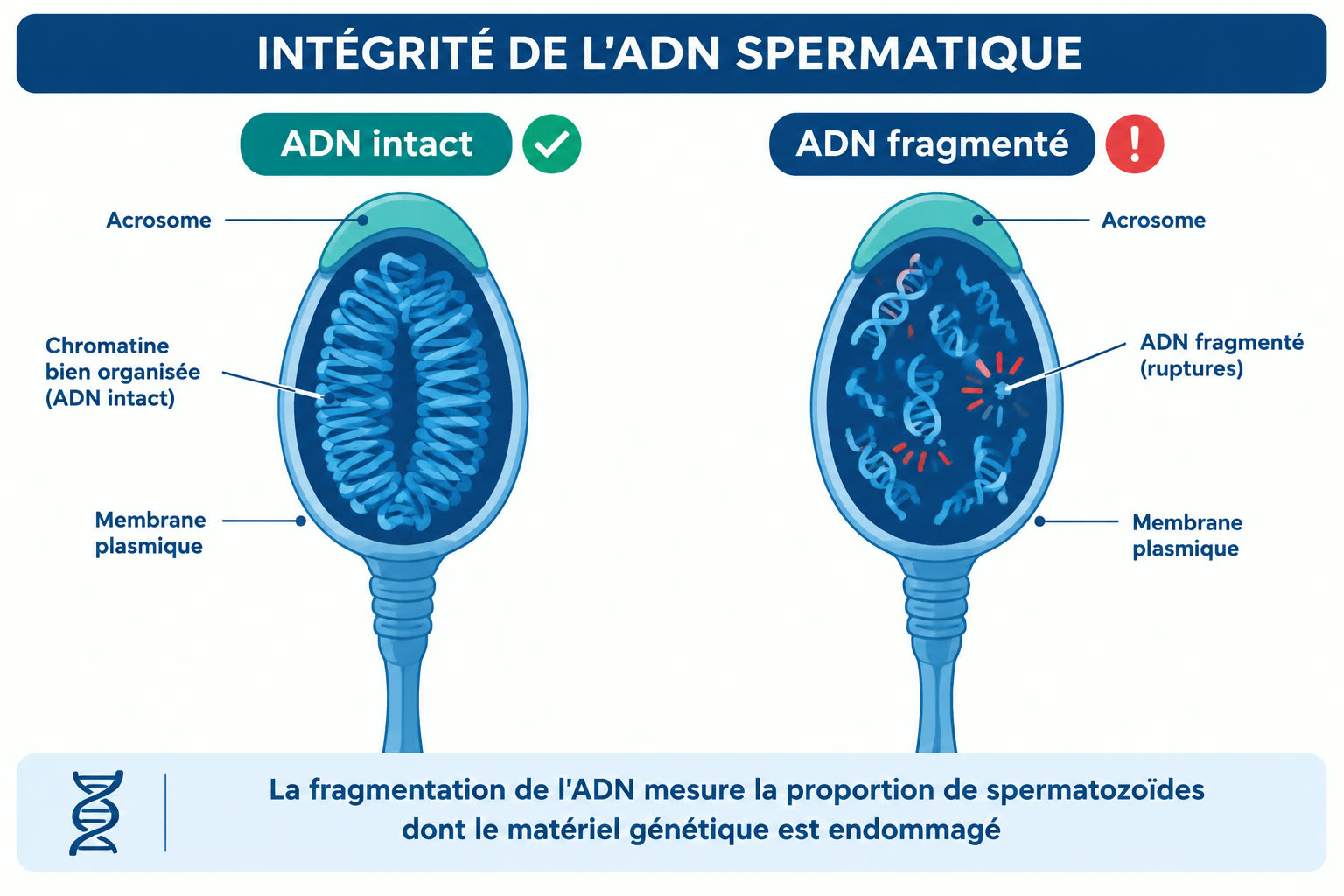 Comparaison schématique de deux têtes de spermatozoïdes en coupe : à gauche une chromatine bien organisée (ADN intact), à droite un ADN fragmenté présentant des ruptures.