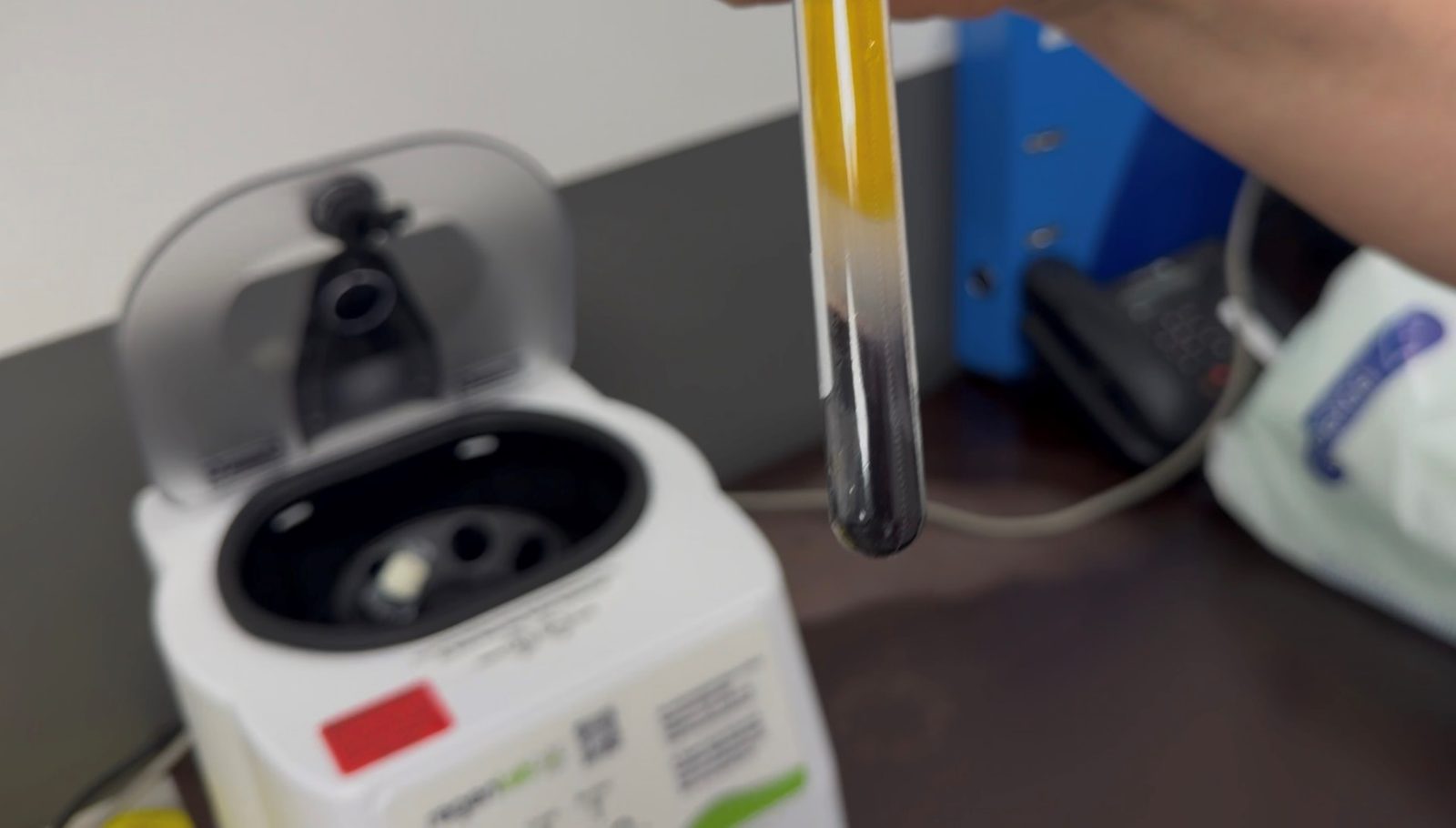 Photographie d'un tube après centrifugation montrant la séparation nette entre le plasma surnageant et le culot de globules rouges.
