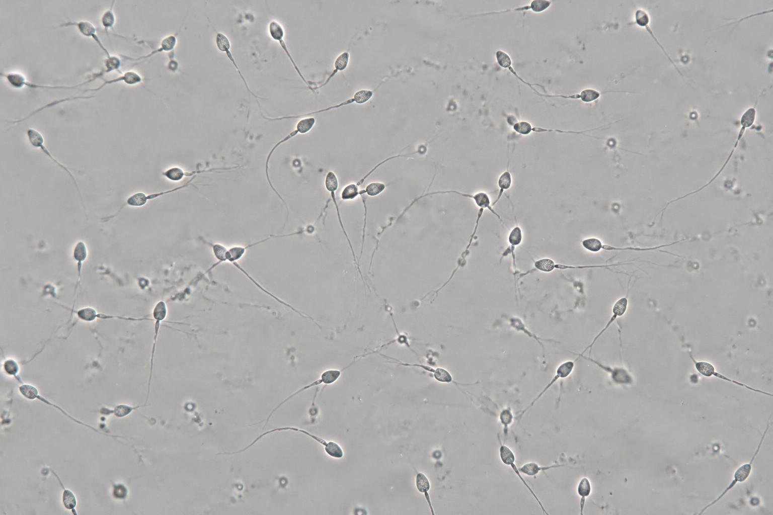 Illustration de spermatozoïdes inspirée de la microscopie optique à contraste de phase ; une image fixe ne renseigne pas sur leur mobilité et ne représente pas un prélèvement de patient.