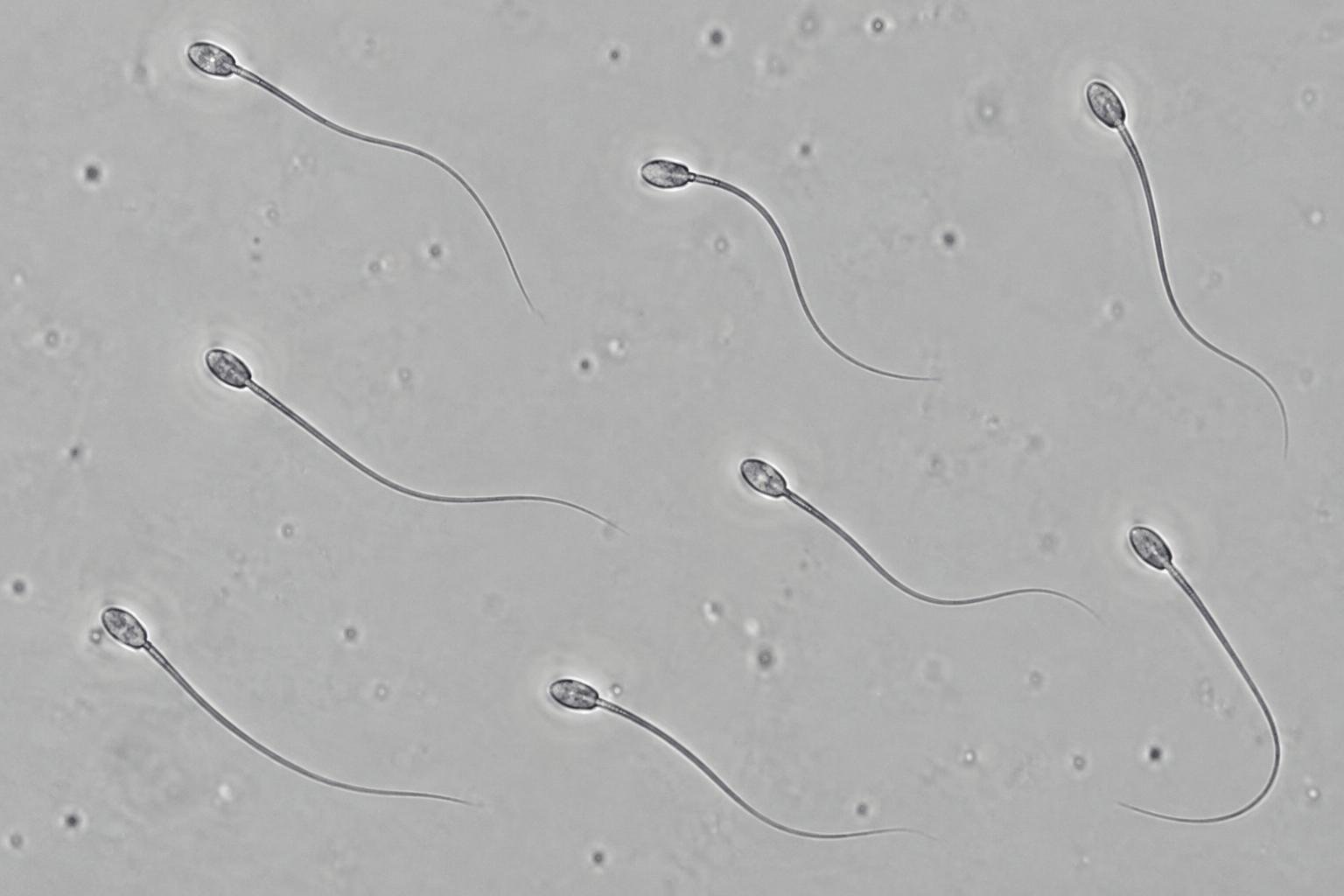 Illustration de spermatozoïdes peu nombreux, inspirée de leur aspect en microscopie optique à contraste de phase ; il ne s'agit pas d'un prélèvement de patient.